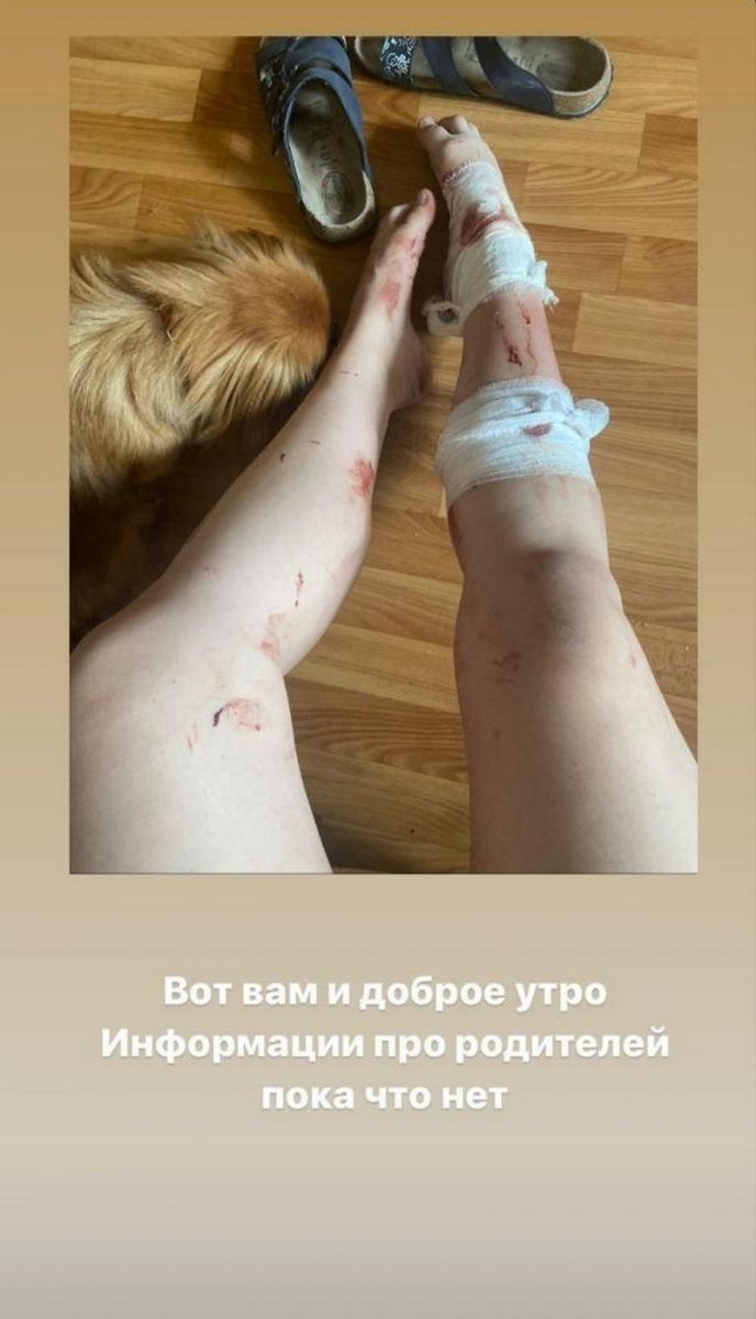 В один миг потеряла семью: шокирующая история чудом выжившей во время взрыва на Позняках киевлянки