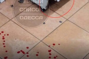  Одесситка подскользнулась и разбила лицо в "Обжоре": как отреагировали в магазине