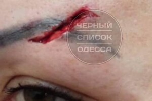  Одесситка подскользнулась и разбила лицо в "Обжоре": как отреагировали в магазине