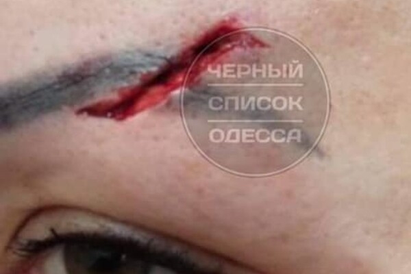  Одесситка подскользнулась и разбила лицо в "Обжоре": как отреагировали в магазине