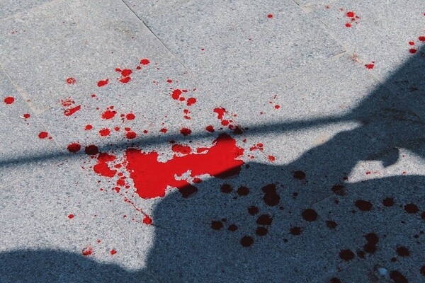 В Одессе избили общественников: они собирали подписи против "Одесса Прайд"