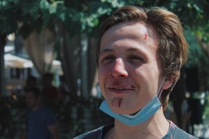 В Одессе избили общественников: они собирали подписи против "Одесса Прайд"