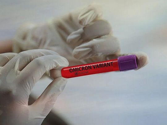 Про штам «Омікрон», його симптоми та перебіг хвороби розповість лікар-інфекціоніст