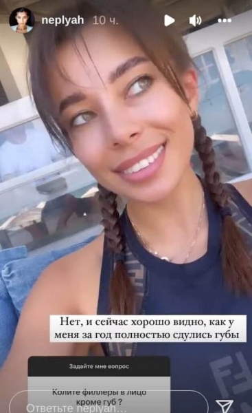 Никакой пластики: Анна Неплях показала, как выглядела в 17 лет