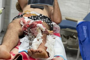Одесские волонтеры призывают помочь раненым военным