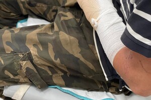 Одесские волонтеры призывают помочь раненым военным